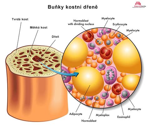 Bunky leukémie v kostnej dreni