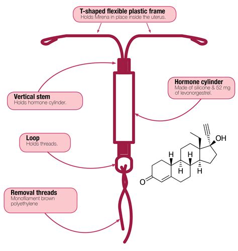 Mirena IUD structure