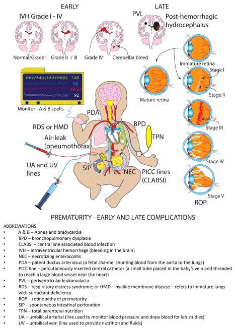 Infographic showing common complications of prematurity