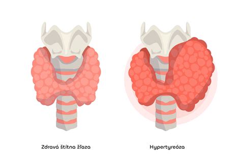 Ľudská štítna žľaza