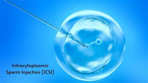 Proces ICSI (intracytoplazmatická injekcia spermie)