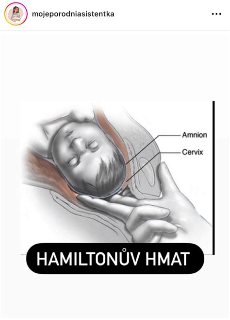 Hamiltonov hmat - ilustrácia