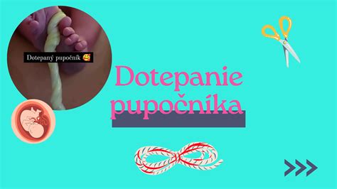 Štruktúra pupočníka