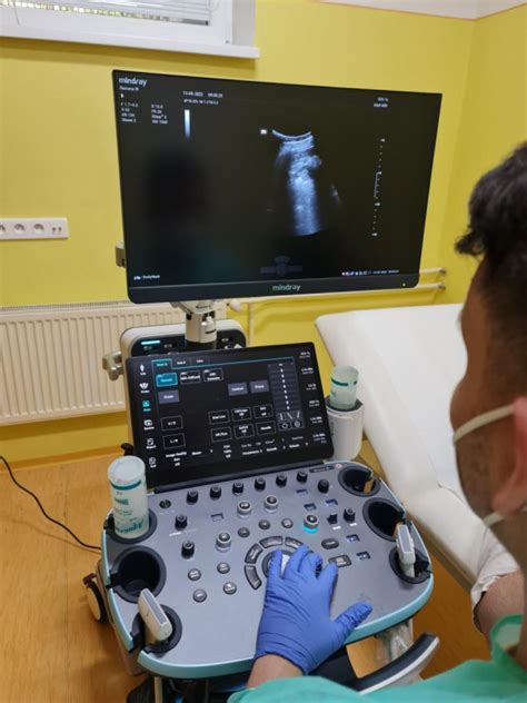 Zobrazenie ultrazvukového prístroja pri vyšetrení