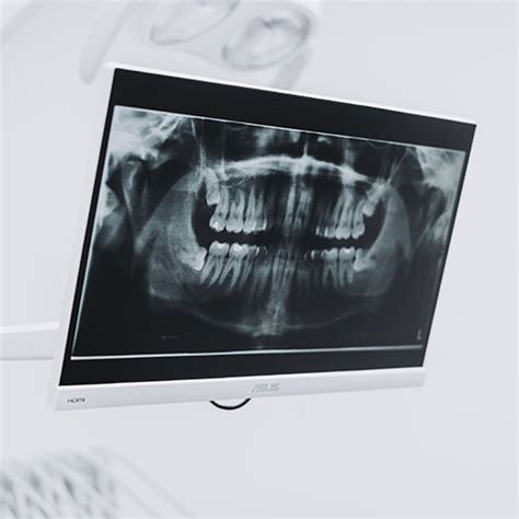 Zubné RTG snímky pre diagnostiku u detí