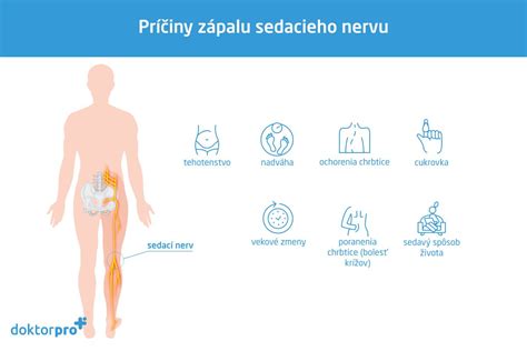 Schéma sedacieho nervu a tlaku maternice