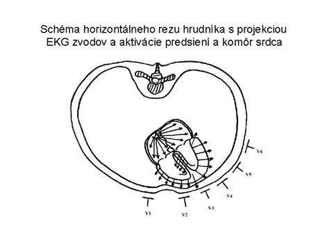 Schéma chirurgického rezu maternice