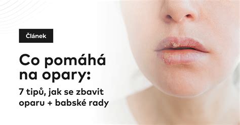 Ilustrácia liekov a mastí na opary