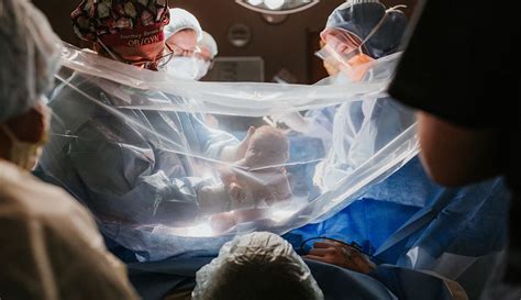 Gentle C-section