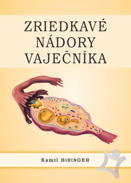 Schéma vaječníka s cystou