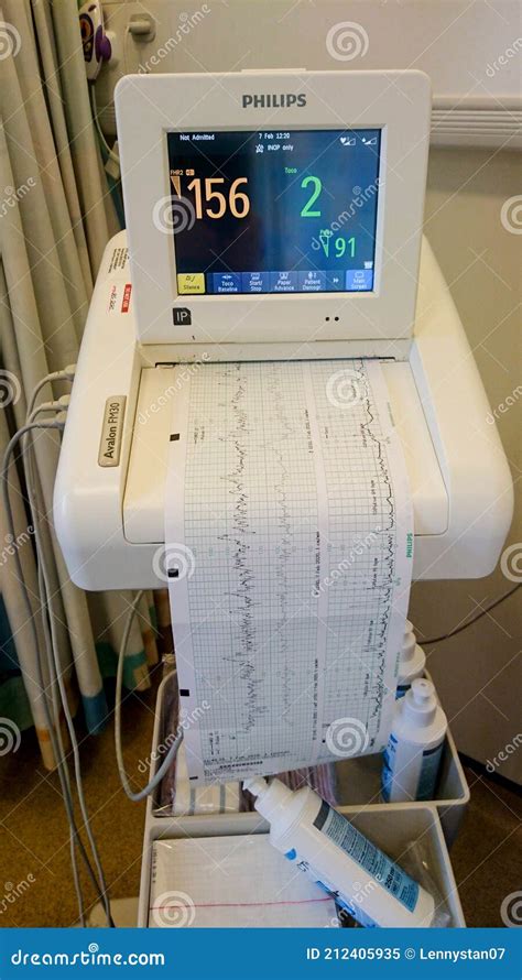 Graf kontrakčnej činnosti (CTG monitor)