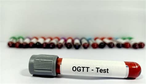 Glukózotolerančný test