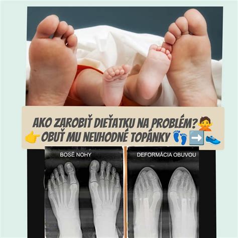 detská chrbtica v porovnaní s dospelou