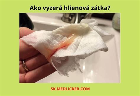 Hlienová zátka a odtok plodovej vody
