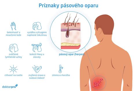 Vývoj kožných prejavov pásového oparu