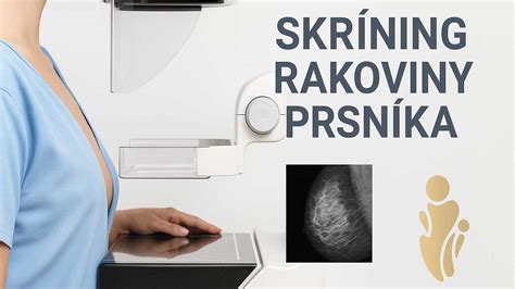 Schéma anatómie prsníka a mliekovodov