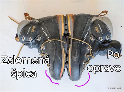 Rozťahovanie maternicových väzov