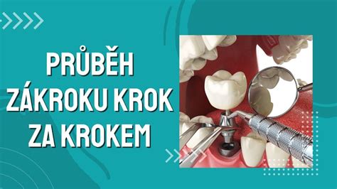 historické vyobrazenie starovekého pôrodníckeho zákroku