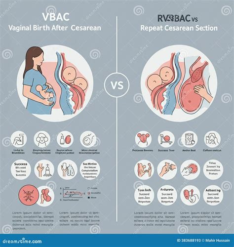 Infografika o VBAC