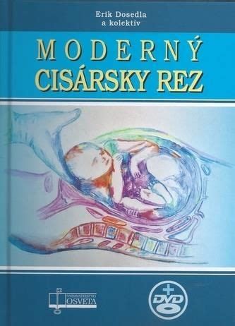Historická ilustrácia znázorňujúca raný cisársky rez
