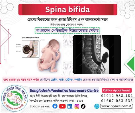 Infografika: Následky Spina Bifida na rôzne telesné systémy