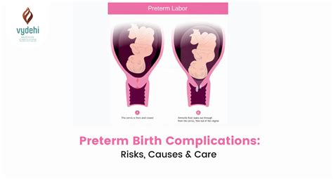 Preterm birth medical care