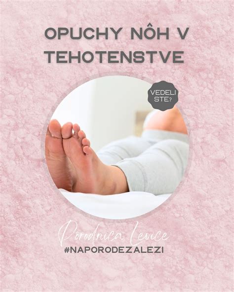 Opuchy nôh v tehotenstve