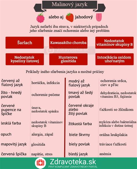 Infografika: Príčiny polyhydramniónu - materské a fetálne faktory