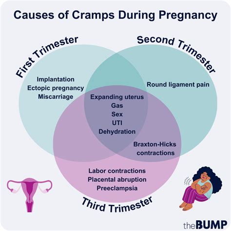 Types of abdominal cramps in early pregnancy diagram