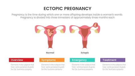 Symptoms of ectopic pregnancy vs. normal pregnancy