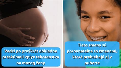 Mozog ženy pred a po tehotenstve