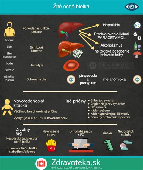 Infografika najčastejších príčin žihľavky