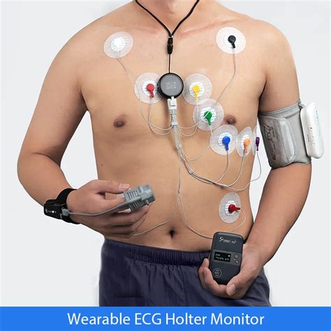 Holter EKG monitoring