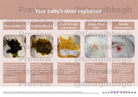 Comparison of baby stool types