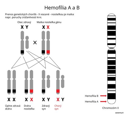 diagram dedičnosti viazanej na X chromozóm