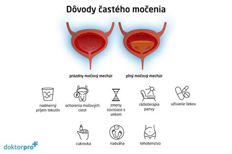 Ilustrácia dieťaťa, ktoré má časté nutkanie na močenie
