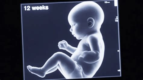 12 week fetus development