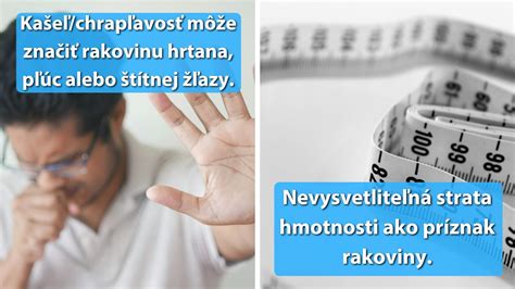 Príznaky, ktoré si vyžadujú lekársku pozornosť