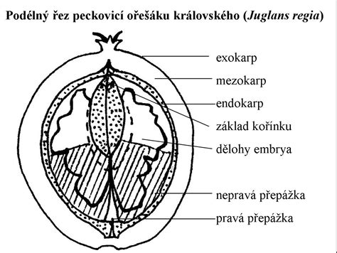 Nákres patologických polôh plodu