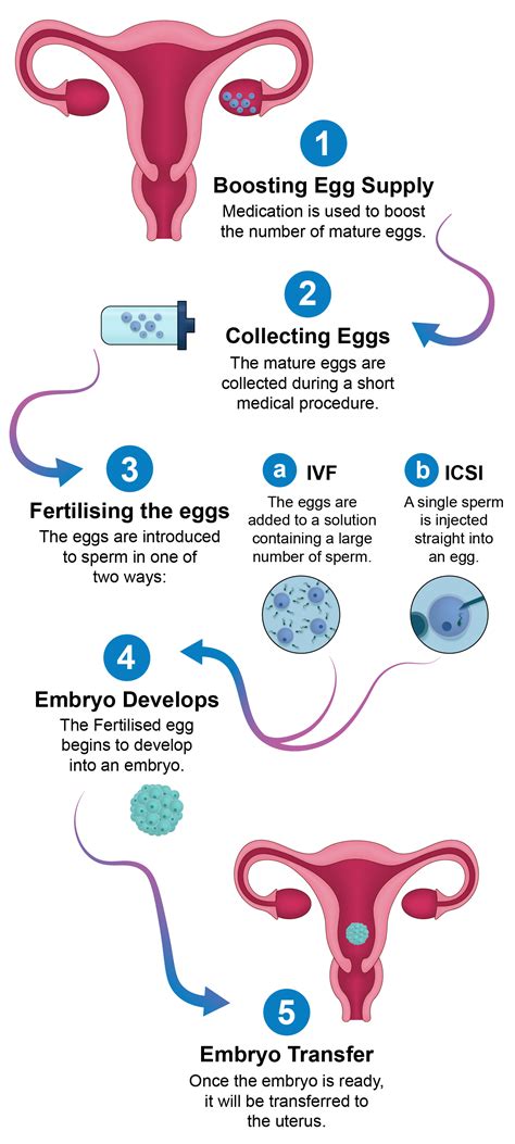 Diagram vysvetľujúci proces IVF