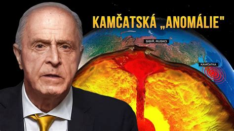 Chromozomálne anomálie
