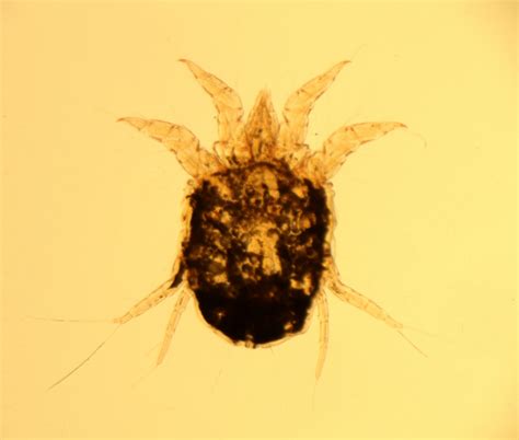 Diagnostika parazitov