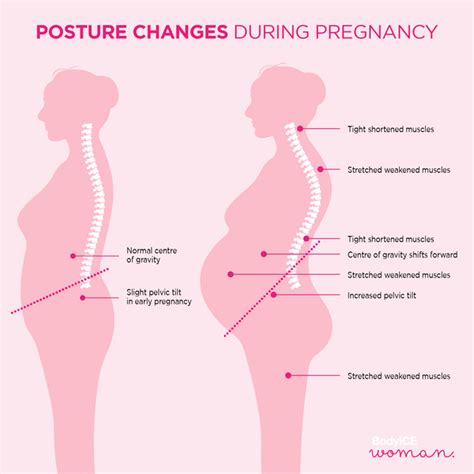 Proper posture during pregnancy to reduce back pain
