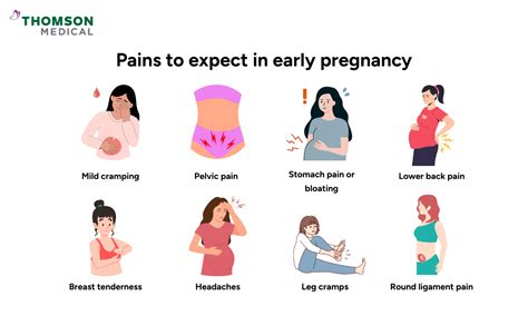 Pain map of common pregnancy pains