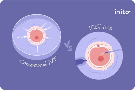 Infografika: Prehľad metód asistovanej reprodukcie (IVF, ICSI, PGD, darcovstvo)