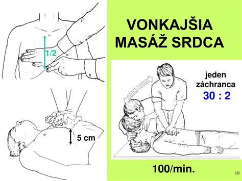 Resuscitácia dieťaťa - masáž srdca a dýchacie cesty