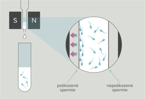 Ilustrácia znázorňujúca proces mrazenia spermií v tekutom dusíku