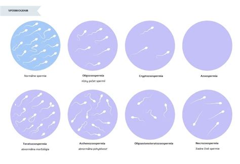 Ilustrácia spermobanky a proces mrazenia spermií