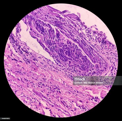 Mikroskopický pohľad na štruktúru kĺbovej chrupavky