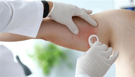 Hormonálna reakcia tela na obmedzenie kalórií